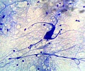 Mysteries of the brain, poverty and student learning (Second part)