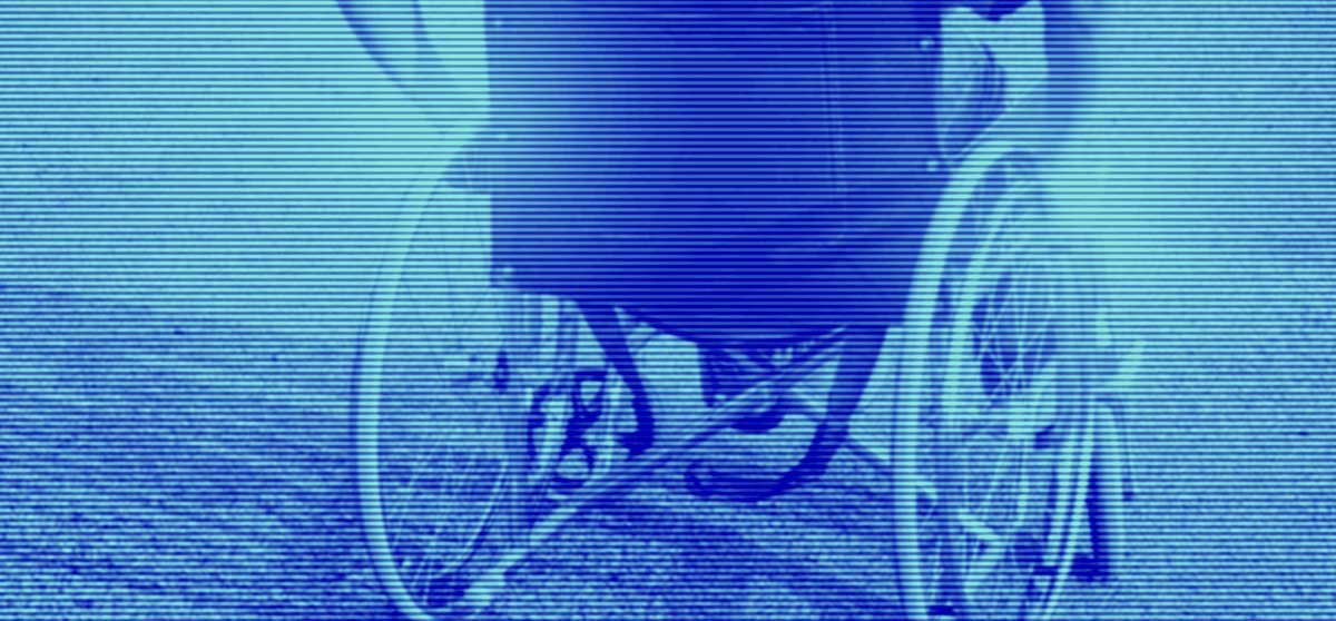 La creatividad en salud es un salvavidas para la discapacidad